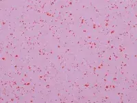 Mipolam Planet 5482 Sugar Drip